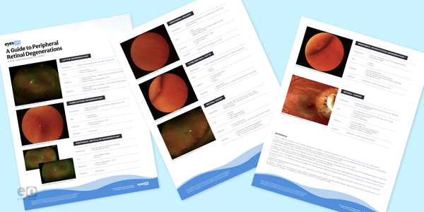 The OD's Guide to Identifying Peripheral Retinal Disease with Cheat Sheet