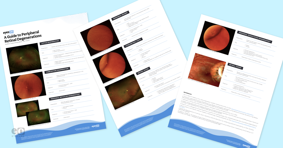 The OD's Guide to Identifying Peripheral Retinal Disease with Cheat Sheet