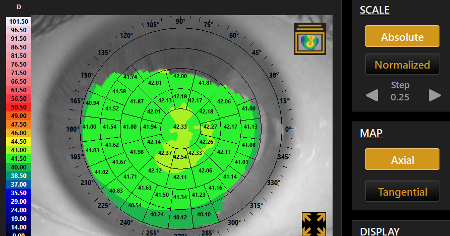 Axial corneal topography