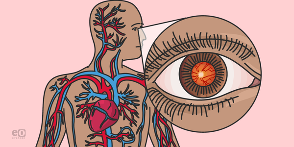 Ocular Manifestations of Systemic Infections: A Concise Overview