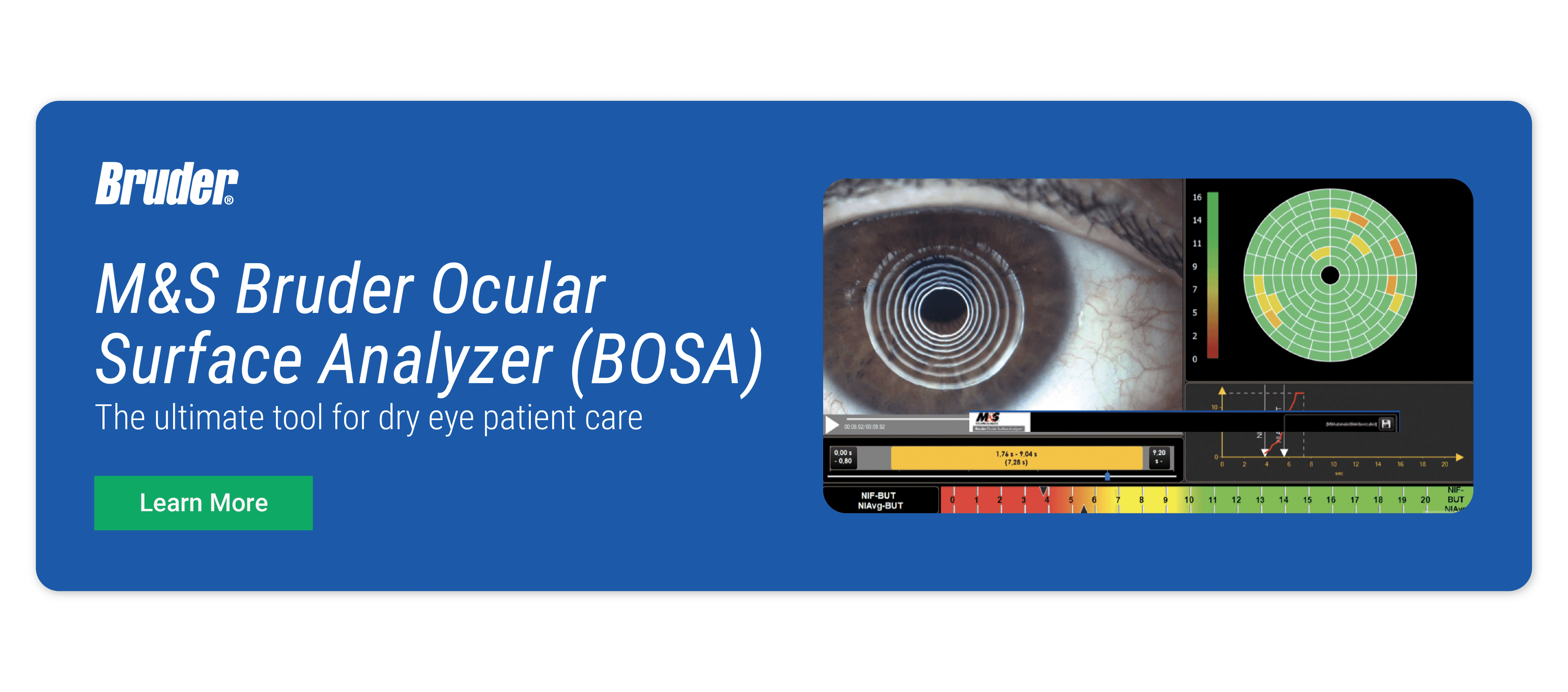 BOSA Ad (Ocular Surface Analyzer)