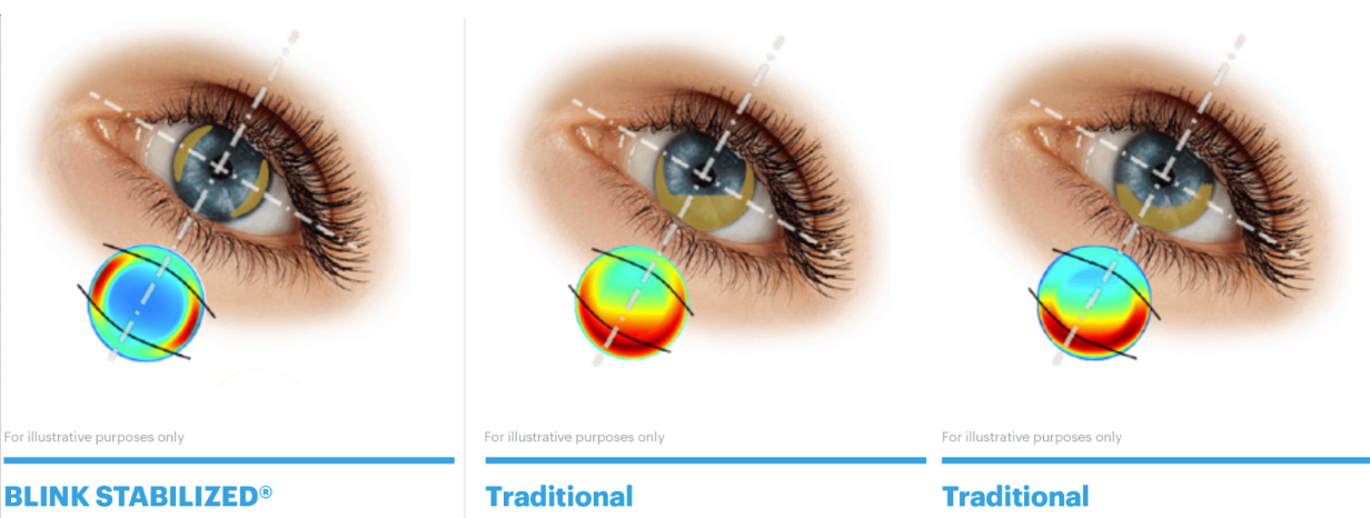 Rotational stability CL J&J