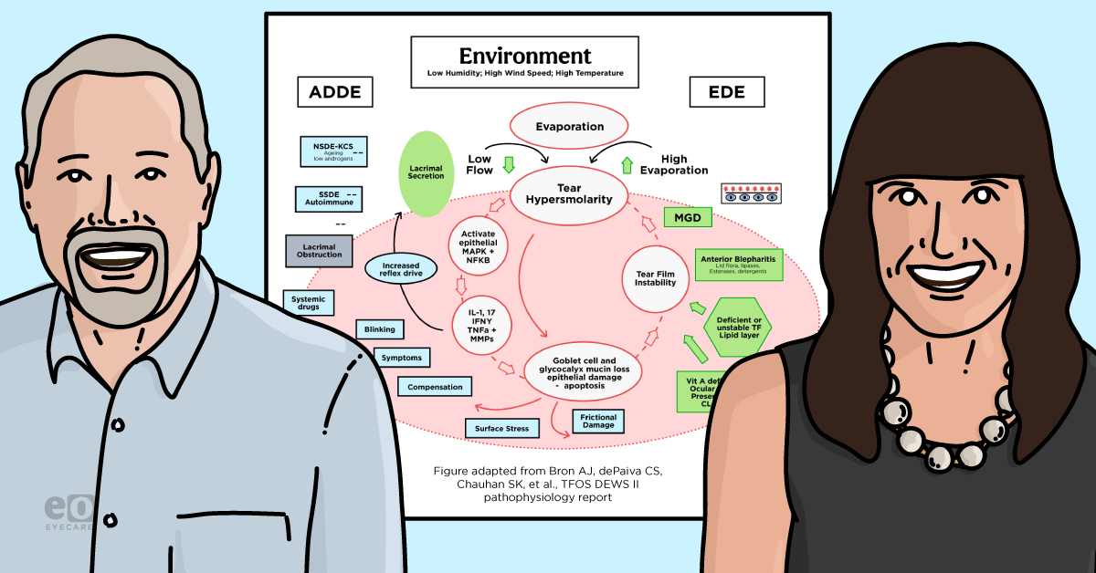 The Ultimate Guide to Evaporative Dry Eye 