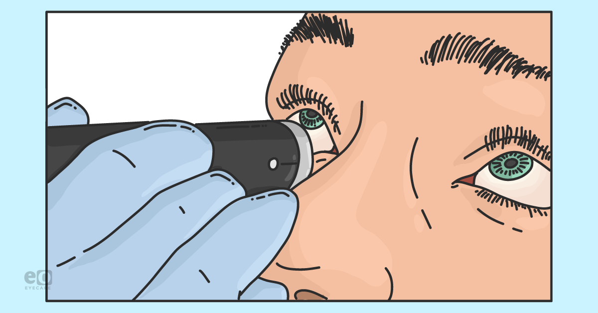 An Overview of B-Scan Ultrasonography in Eyecare 