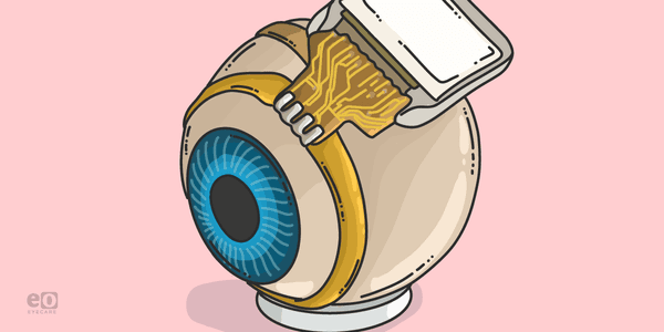 Focus on the Future: Bionic Implants for  Ocular Diseases