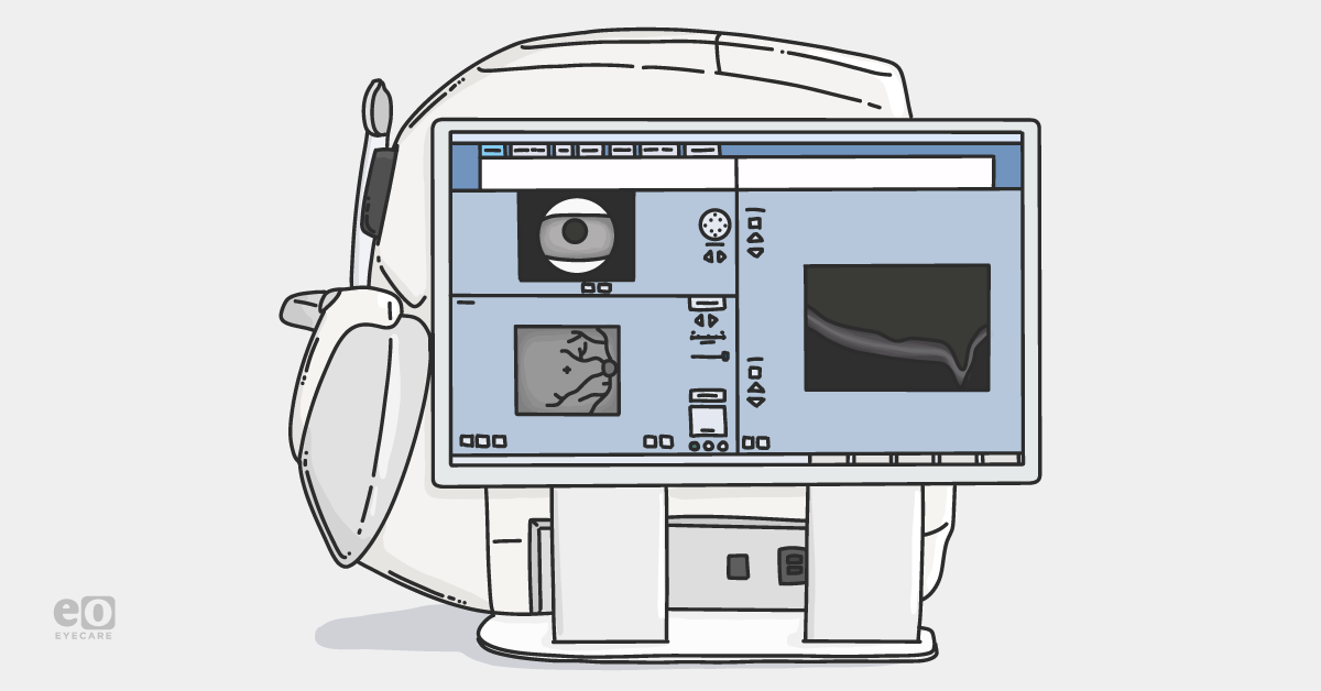 Redefining Early Detection - The ZEISS CIRRUS 6000 is Intelligently Advancing OCT