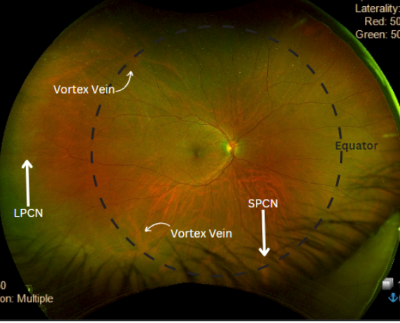 Peripheral Retinal Anatomy