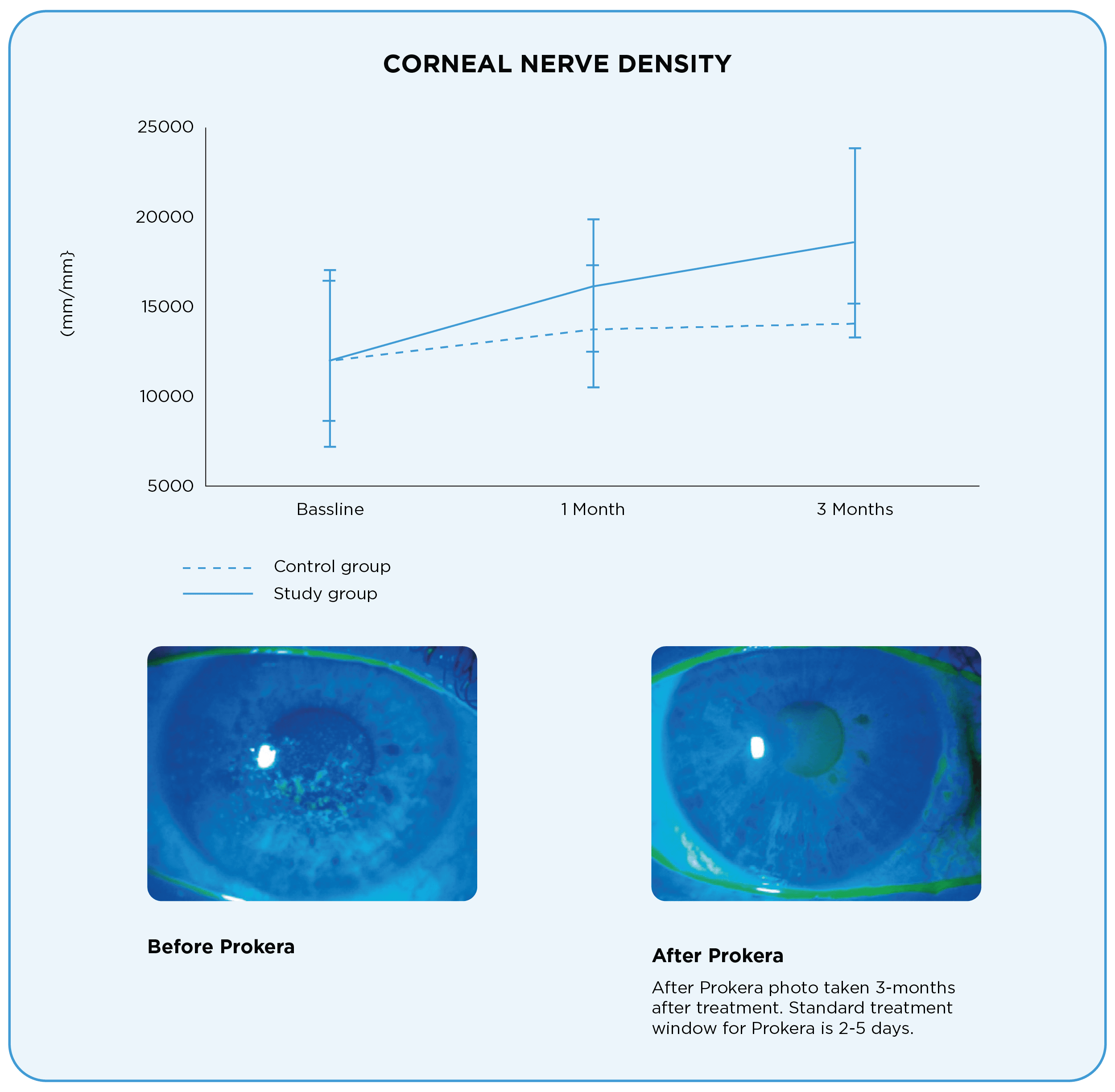 corneal nerve density