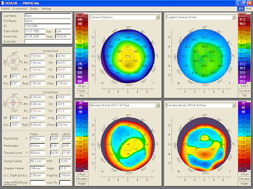 https://covalentcareers3.s3.amazonaws.com/media/original_images/LASIK_pachemetry.png