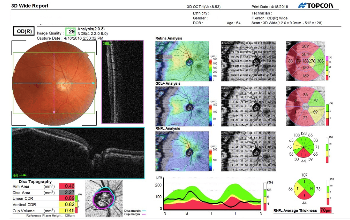 Why Optometrists Should Be Medically Billing