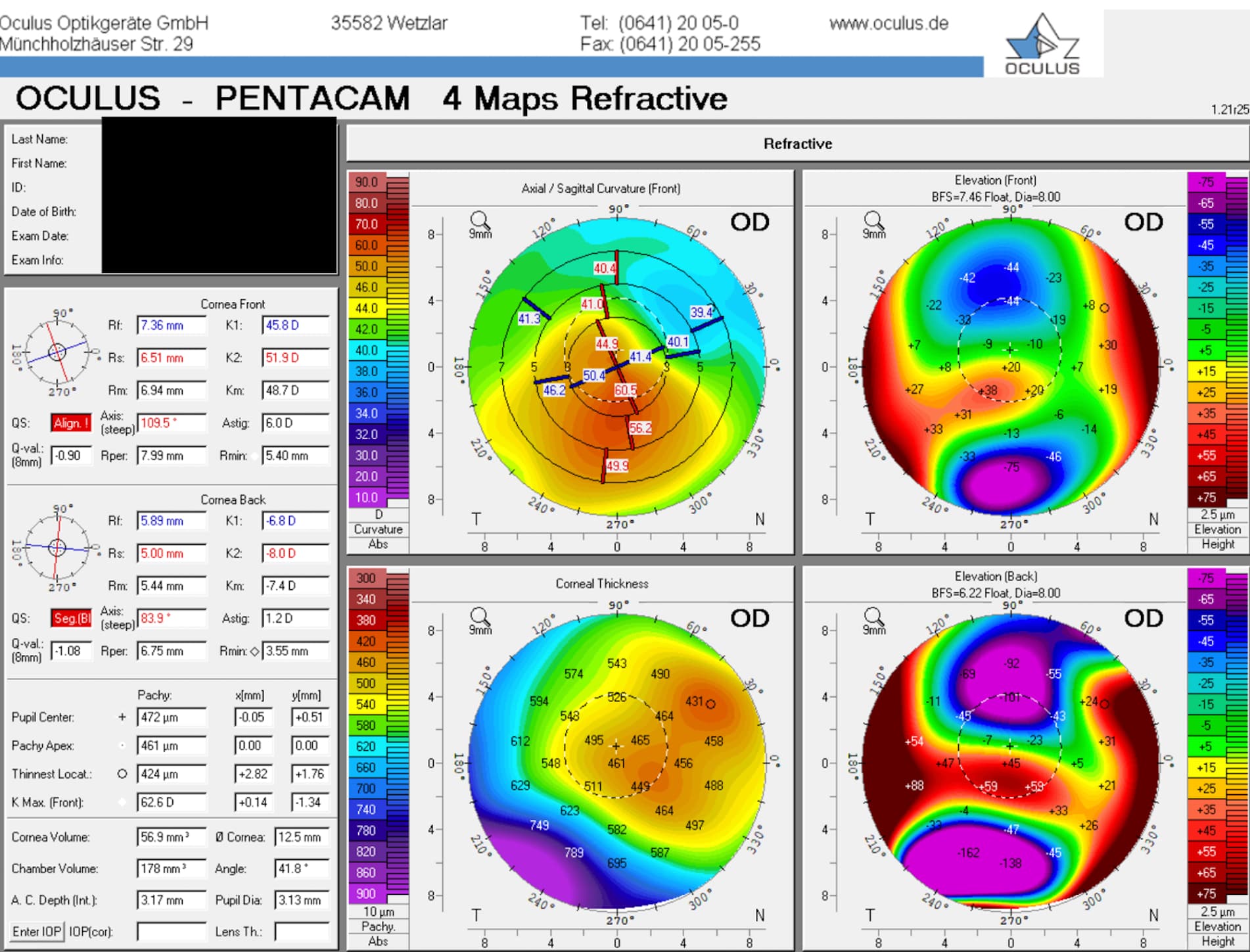 A Guide to Corneal Topography with Cheat Sheet