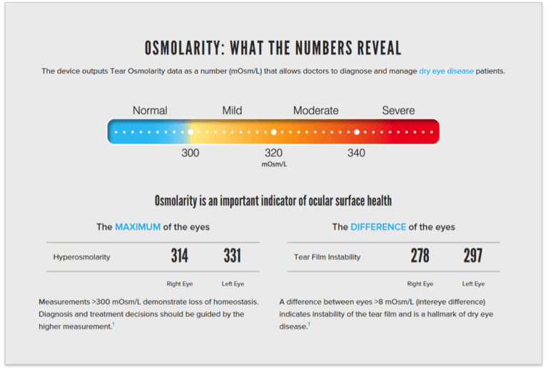 Utilizing TearLab’s Osmolarity System and RPS’s InflammaDry in Dry Eye ...