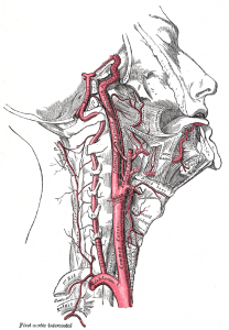 http://www.newgradoptometry.com/wp-content/uploads/2013/11/carotid-dissection-optometry-208x300.png
