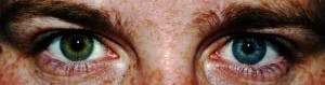 http://www.newgradoptometry.com/wp-content/uploads/2013/11/heterochromia-pediatrics-300x79.jpg