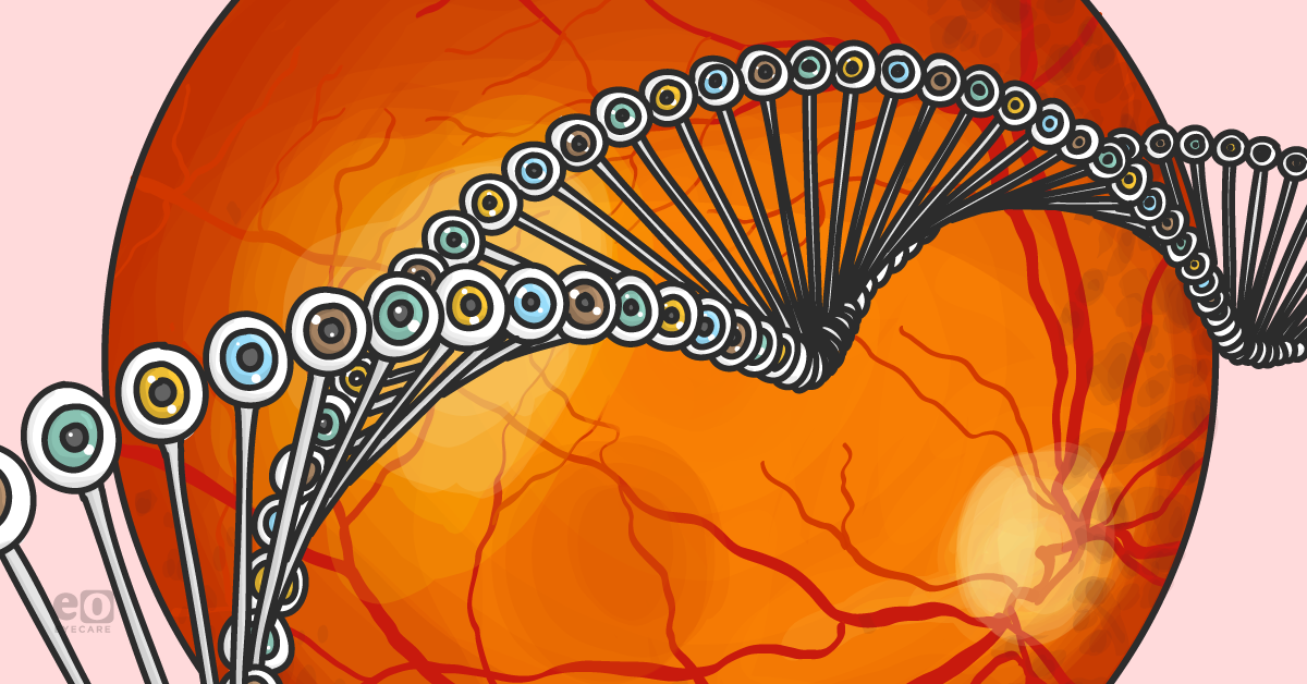 Literature Review: Genetics and Ocular Tumors