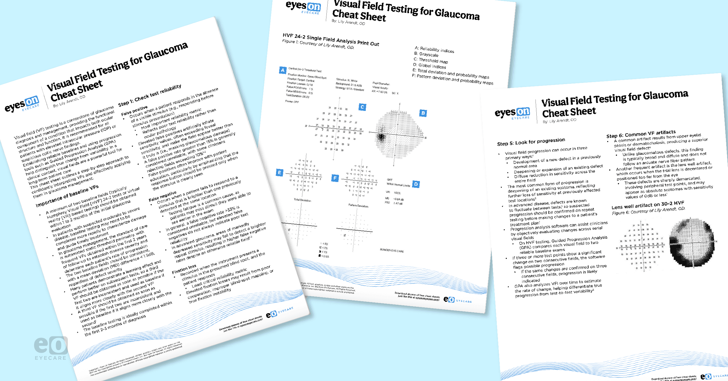 How to Interpret Visual Field Testing with Cheat Sheet