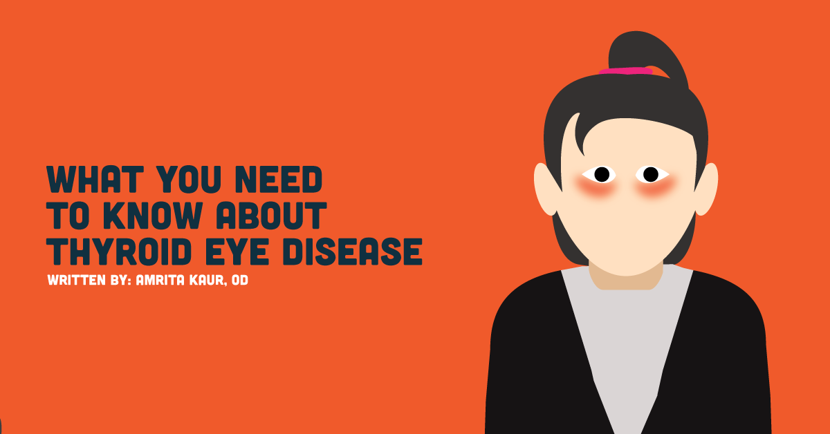 What You Need To Know About Thyroid Eye Disease