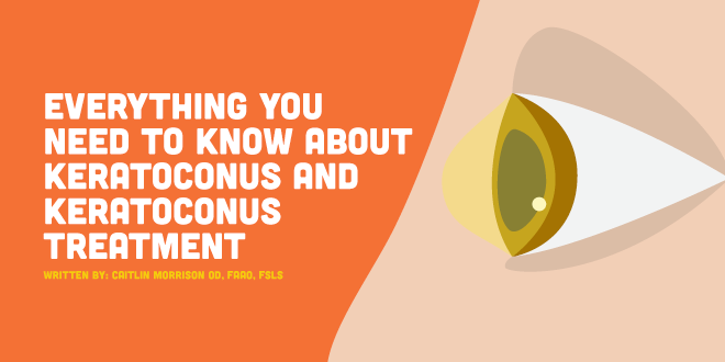 Keratoconus Treatment – Everything You Need to Know