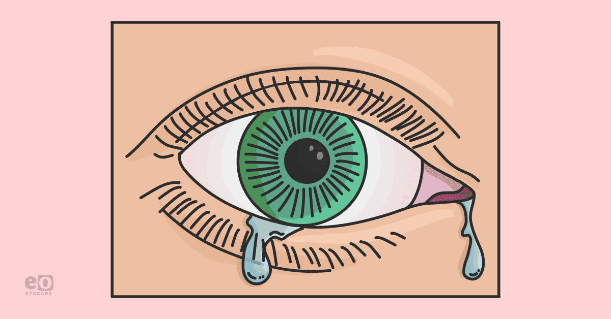 Image of a patient with tears in their eyes due to improper tear drainage, which can be treated with a dacryocystorhinostomy.