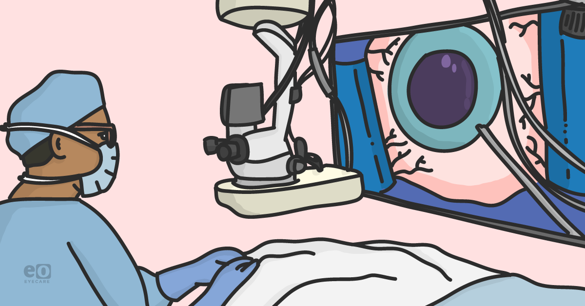 3D Cataract Surgery - The Ophthalmology Resident's Guide
