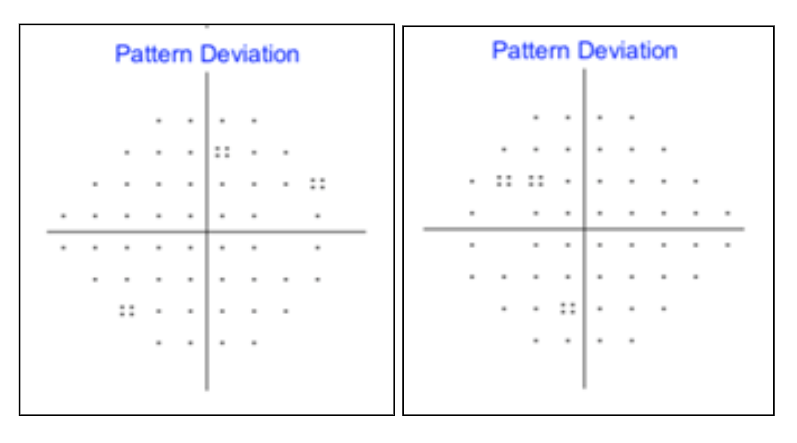 Pattern Deviation SITA standard