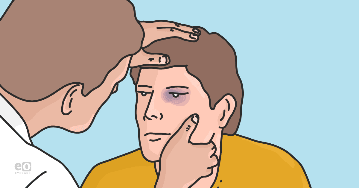 Image of an eyecare practitioner examining a patient with a bruise on their left eye.