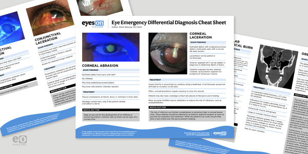 Common Eye Emergencies with Differential Diagnosis Cheat Sheet