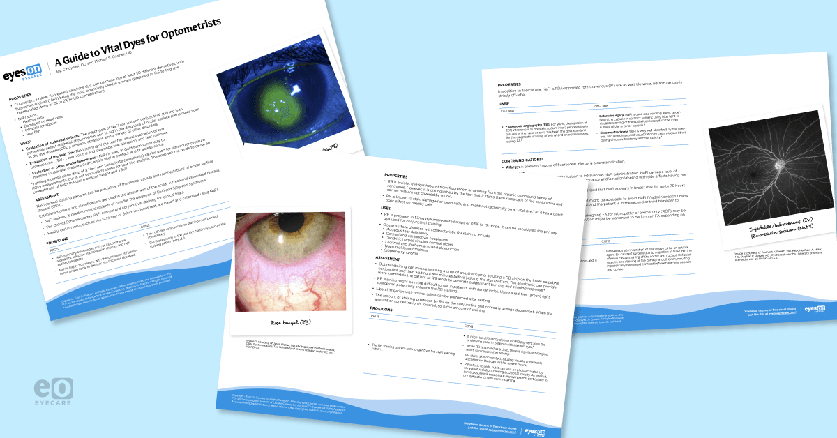 Image of pages from a cheat sheet by Eyes On Eyecare about dyes used in eyecare .