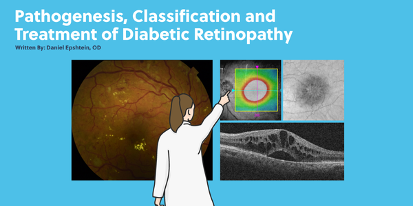 Pathogenesis, Classification, and Treatment of Diabetic Retinopathy