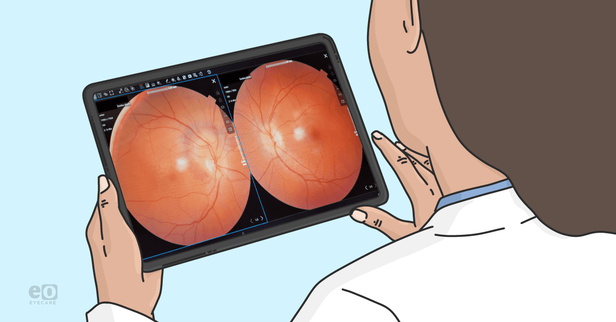 More Than Routine: Complex Cases Managed By Optometrists In National Vision Locations