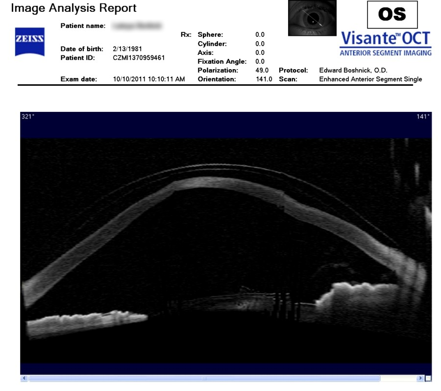 Zeiss Image Analysis Report