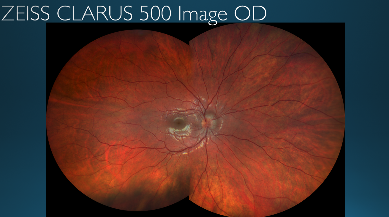 Figure 20 shows the patient’s right eye. There is optic nerve pathology.