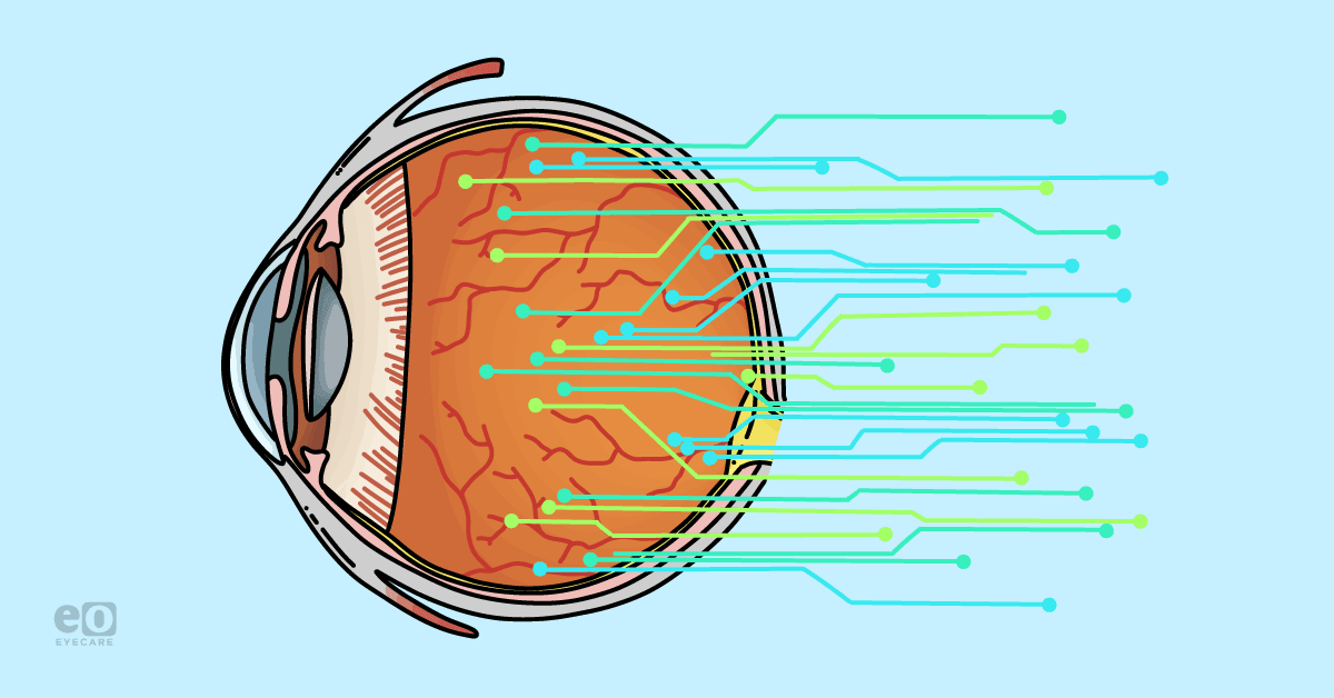 Image of an eyeball with circuitry and wires coming out of the back to represent artificial intelligence (AI) in optometry.