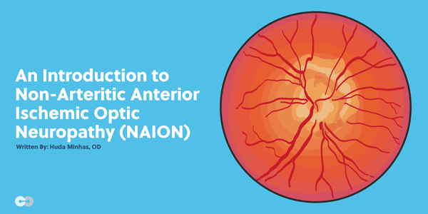An Introduction to Non-Arteritic Anterior Ischemic Optic Neuropathy (NAION)