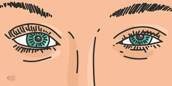The Ultimate Guide to Assessing Eyelid Ptosis