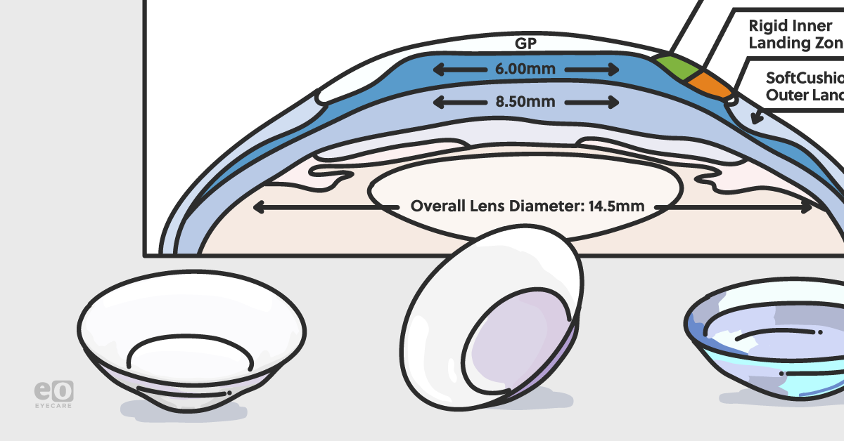 The Complete Guide to SynergEyes Hybrid Contact Lenses