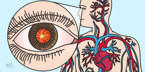 Encountering Systemic Disease in the Optometry Exam Lane