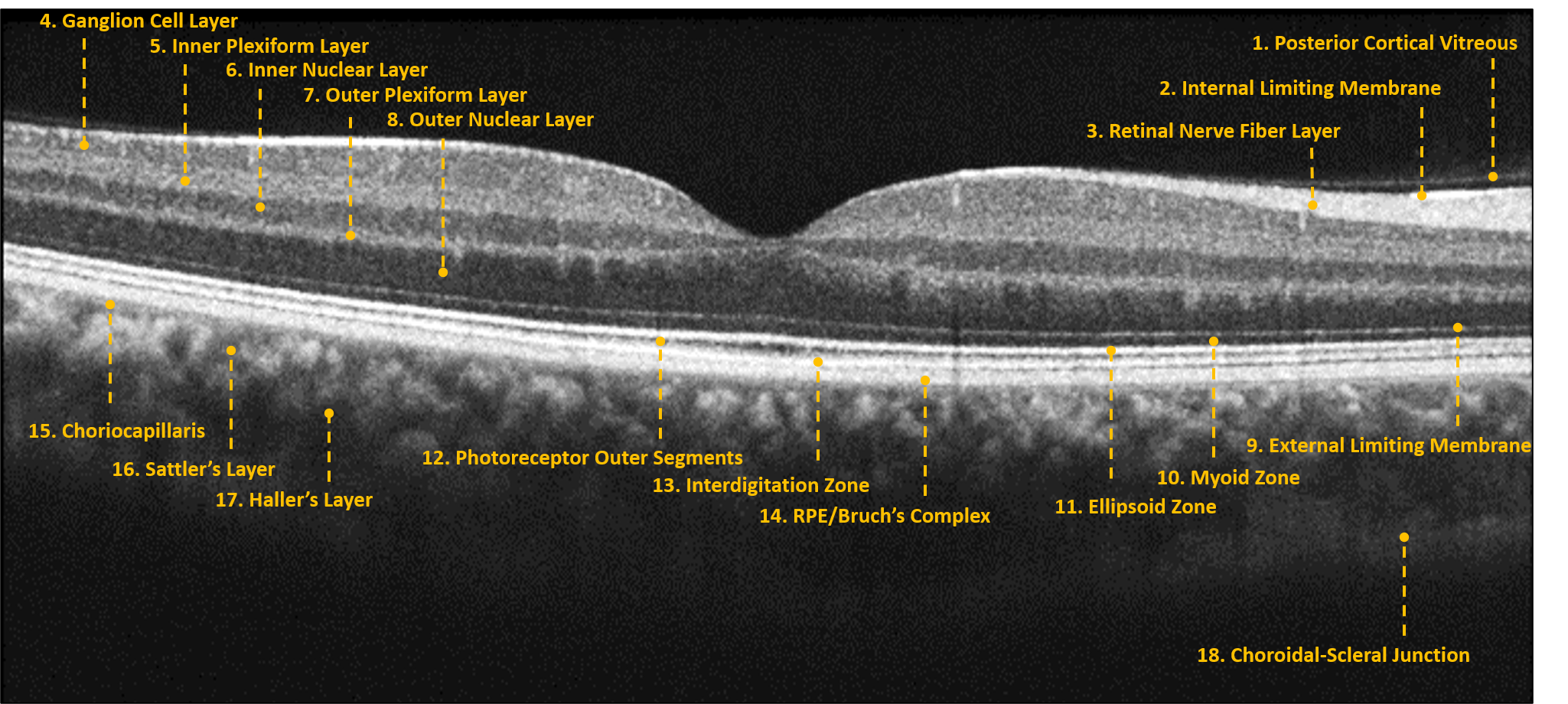 normal macular OCT B-scan