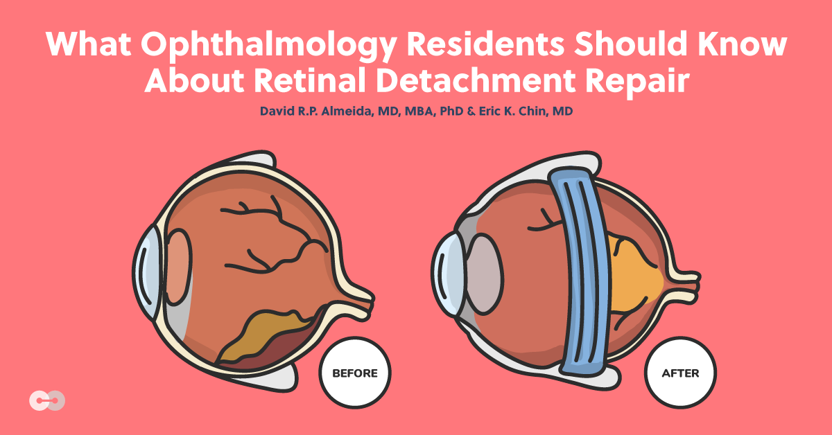 What Ophthalmology Residents Should Know About Retinal Detachment Repair