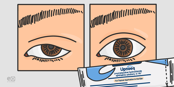 The Ultimate Guide to Upneeq® for Eyelid Ptosis