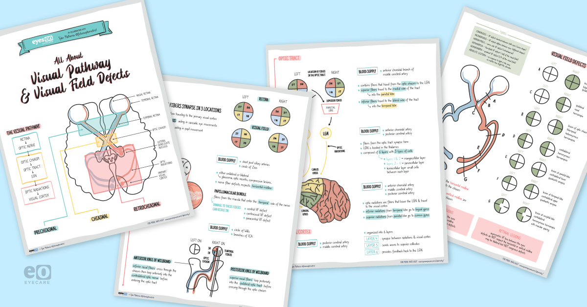 All About Visual Pathway and Visual Field Defects: Downloadable Cheat Sheet
