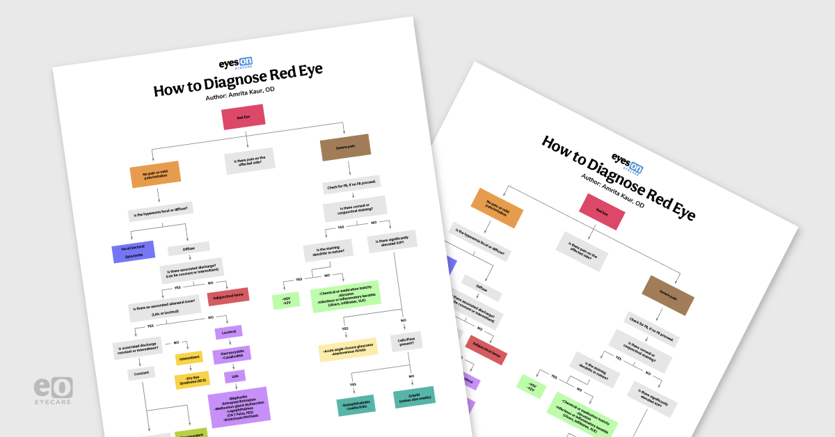 How To Diagnose Red Eye - with Downloadable Flowchart