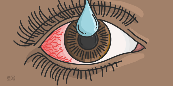 The Ultimate Guide to StimulEyes for Dry Eye