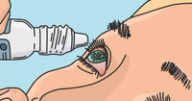 Topical Ophthalmic Medication Guide: Steroids and NSAIDs