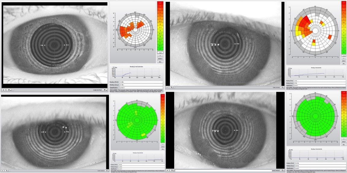 The Psychology of Dry Eye Inread Image 2 NIKBUT