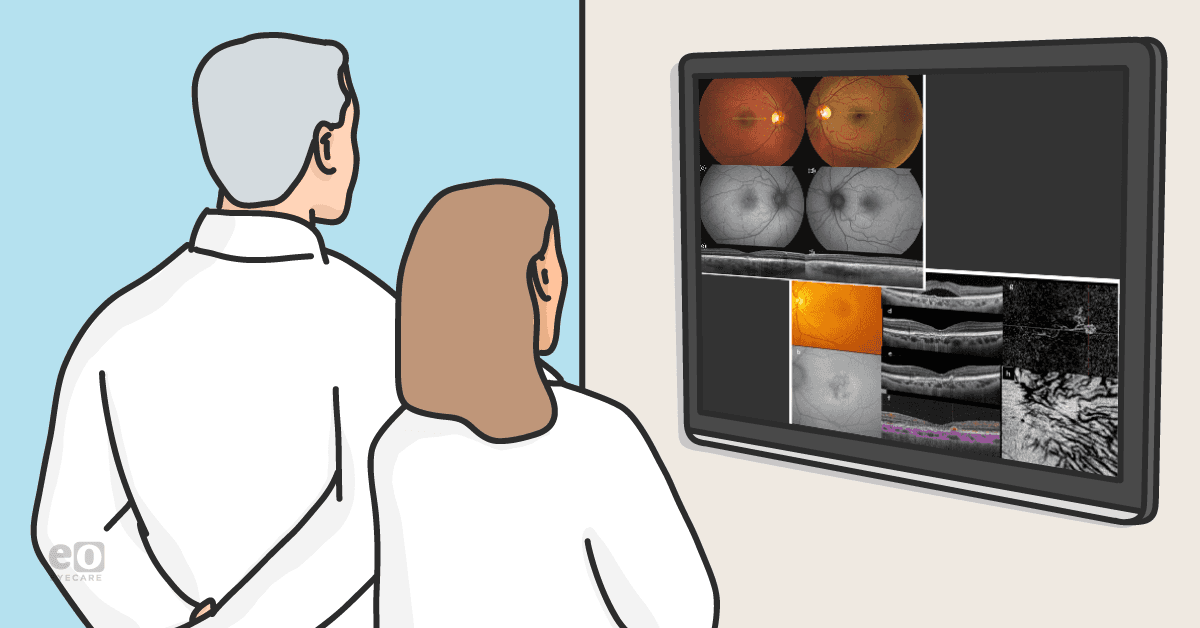 Image of two eyecare practitioner's comparing OCT scans of various pachychoroid spectrum conditions.