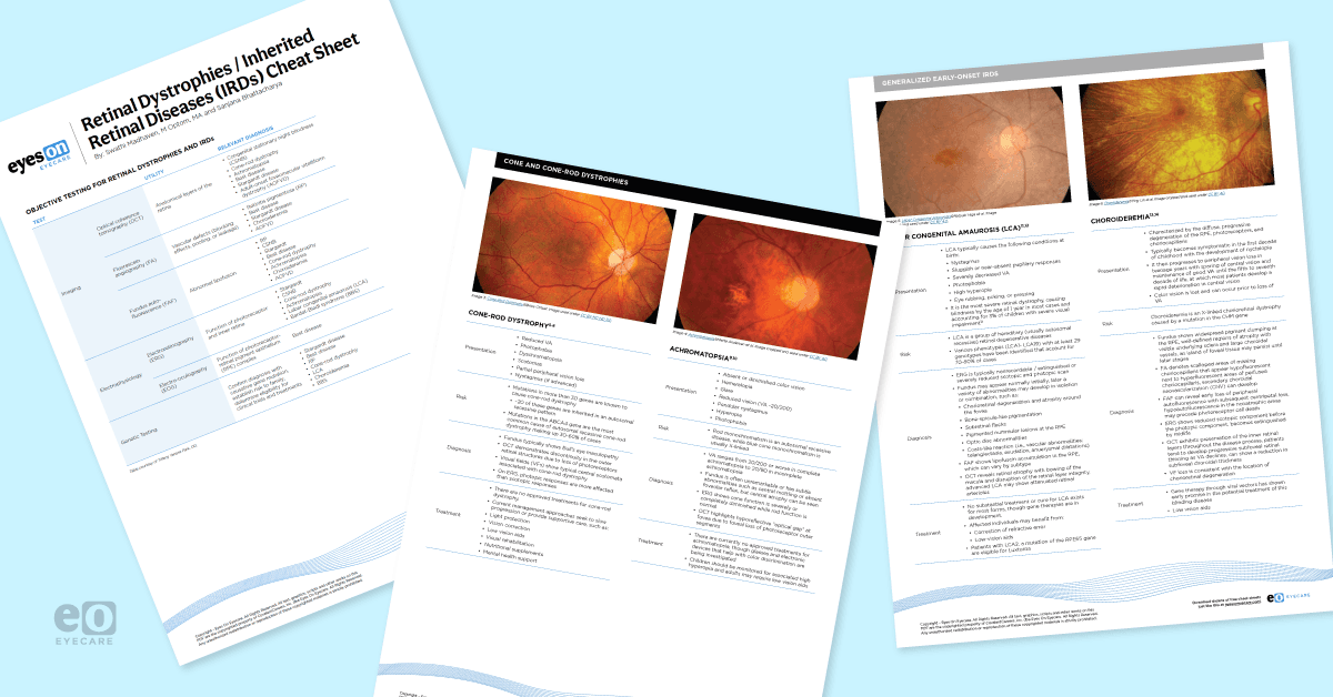 Image of three pages from the Retinal Dystrophies and IRDs Cheat Sheet with fundus photos and clinical findings on imaging.