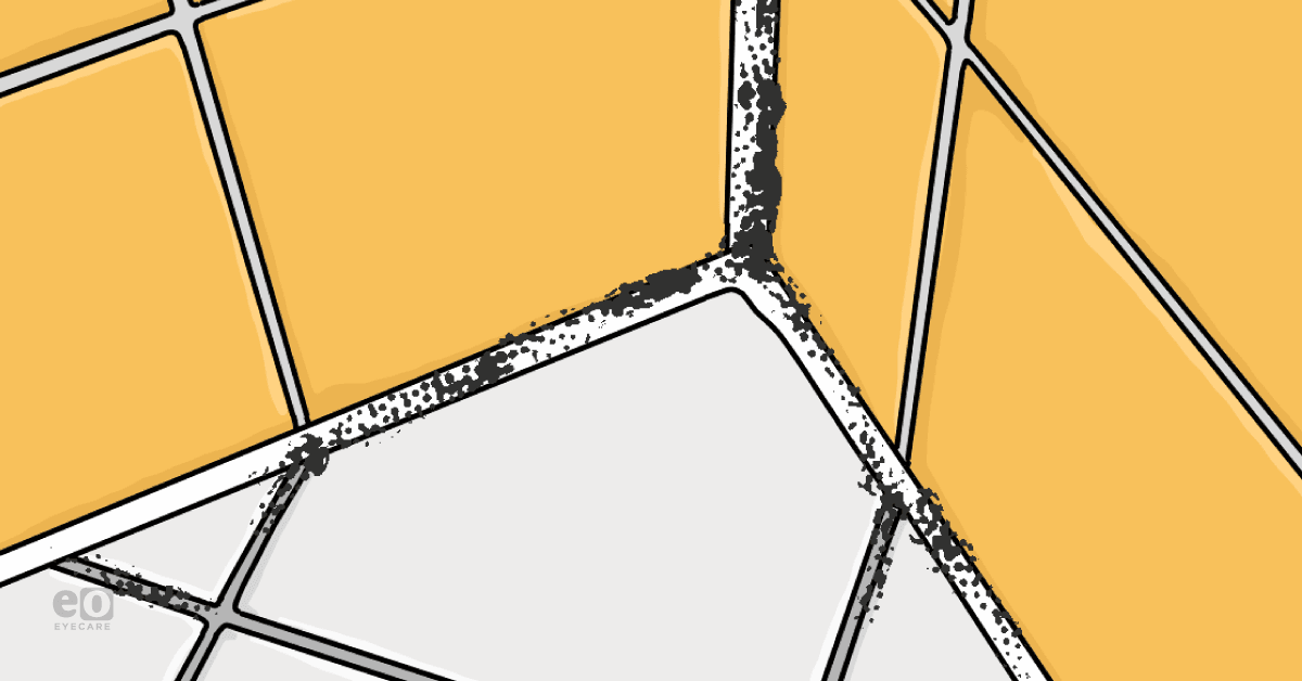 Image of black mold in a home to represent the impact of black mold on ocular health.