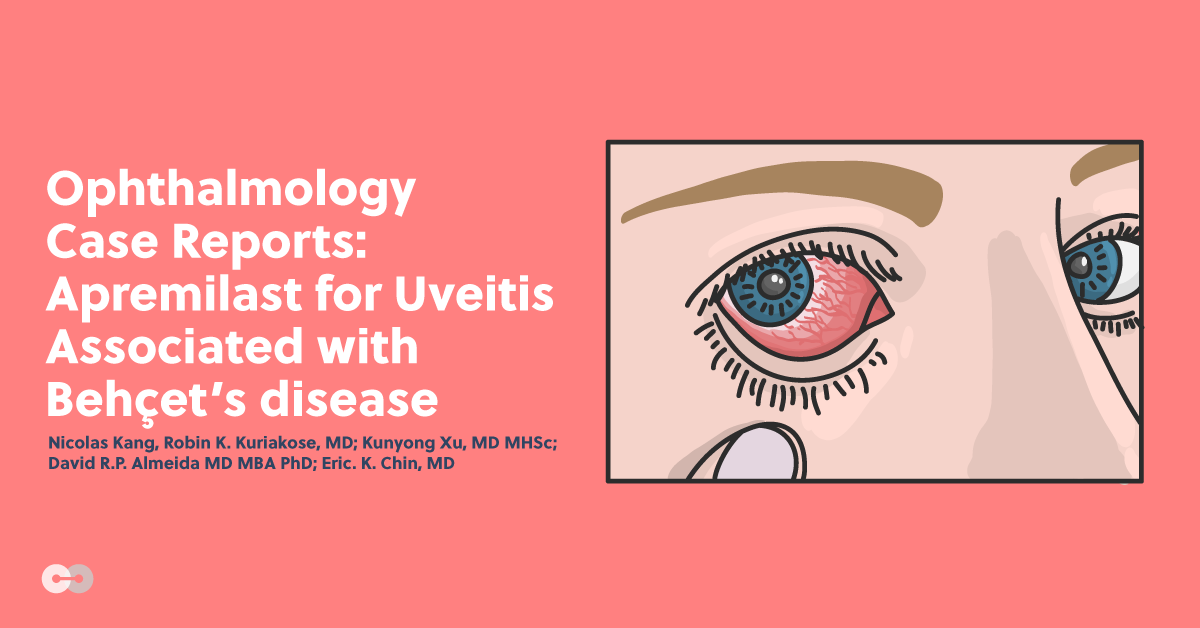 Ophthalmology Case Reports: Apremilast for Uveitis Associated with Behçet’s Disease
