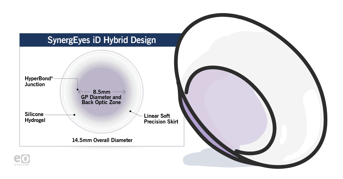 Introducing the Next Generation in Hybrid Contact Lenses: SynergEyes iD